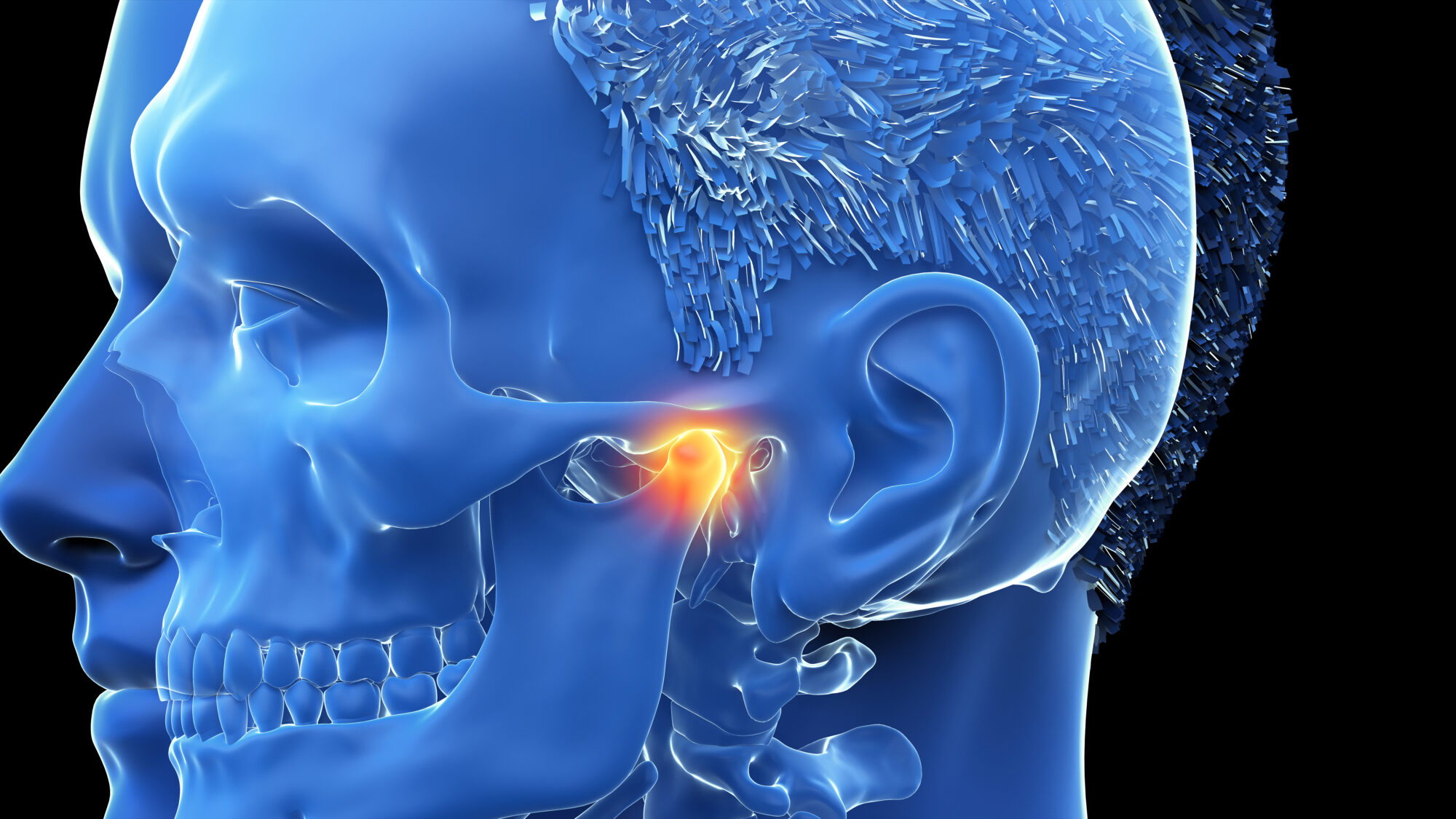 Temporomandibular Disorders