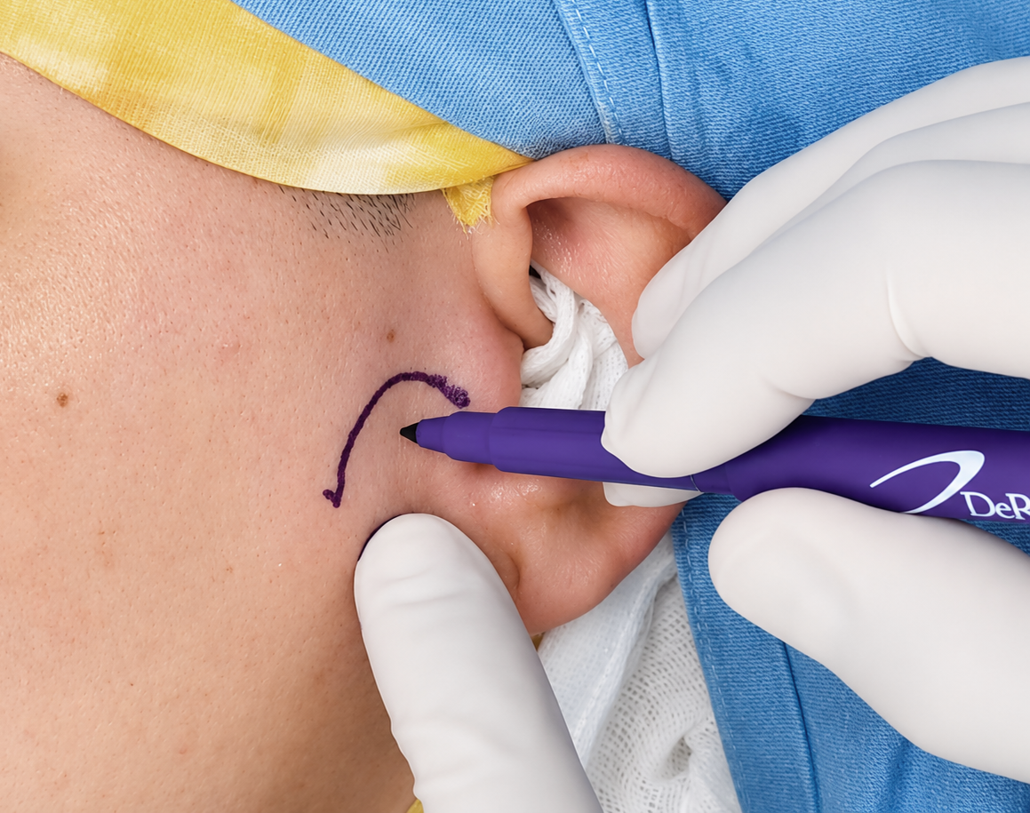 TMJ Arthroscopic Surgery